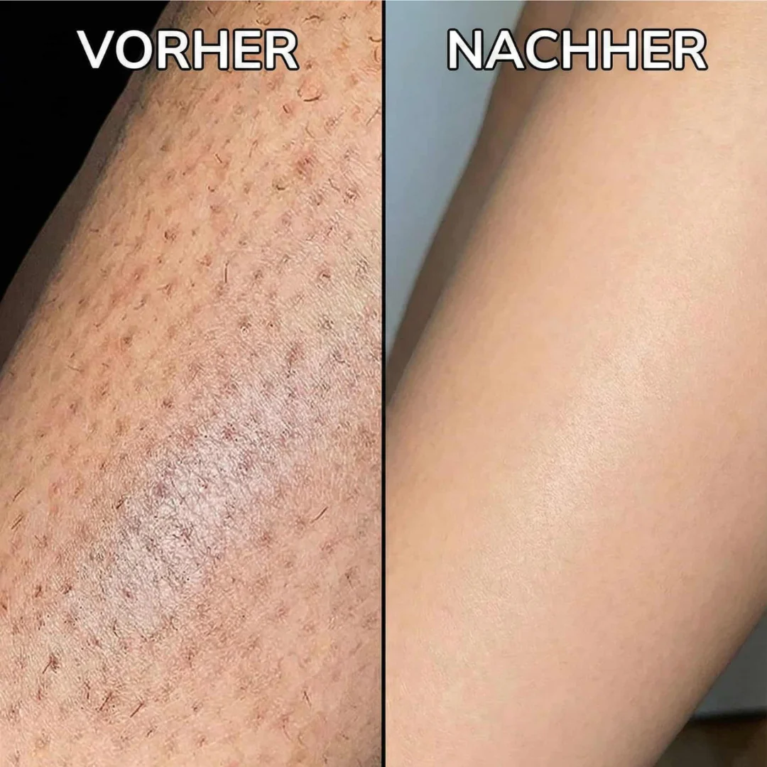 Sérum végétal pour ralentir la pousse des cheveux - Image 3