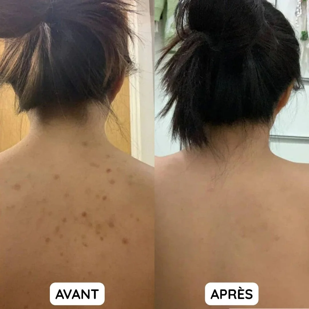 Serviette Exfoliante pour Douche - Image 3