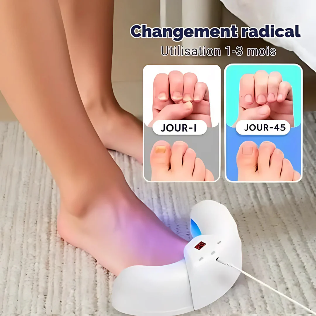 Dispositif LED anti-mycoses des ongles â Soin rapide et naturel