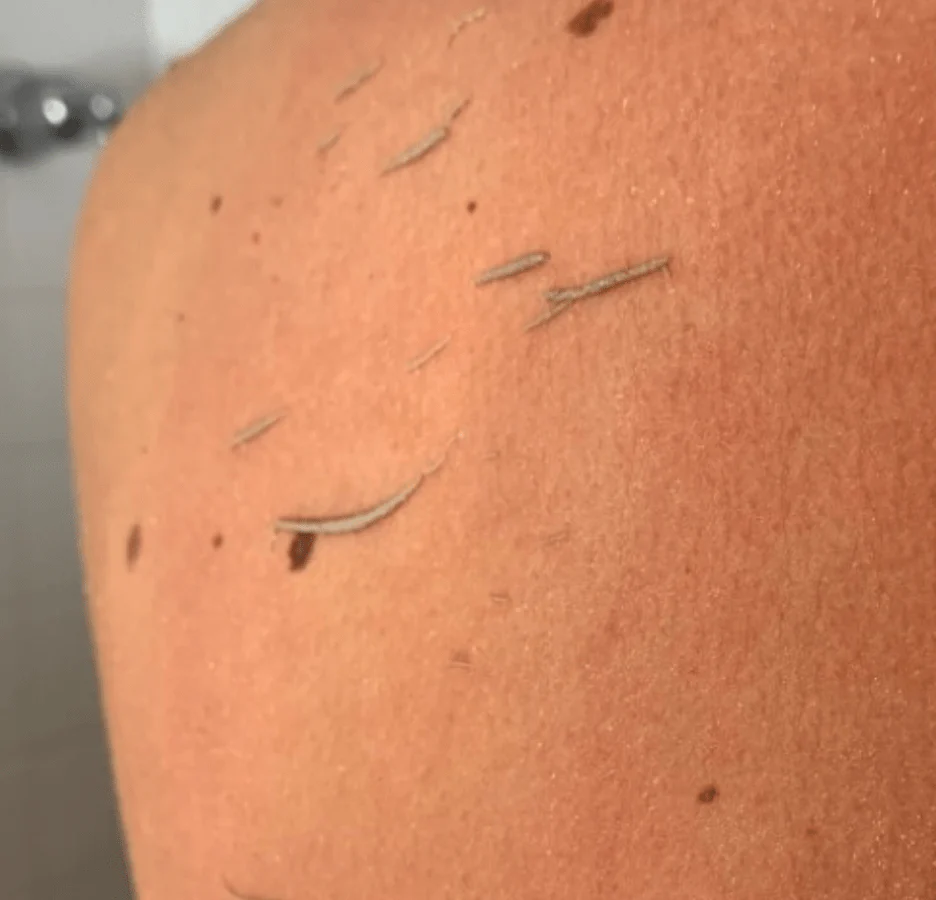 Gant exfoliant en profondeur - Image 3